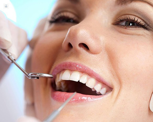 Exploring Root Canal Removal in Odessa: What You Need to Kno