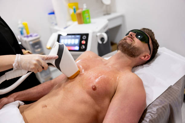 best laser hair removal near me