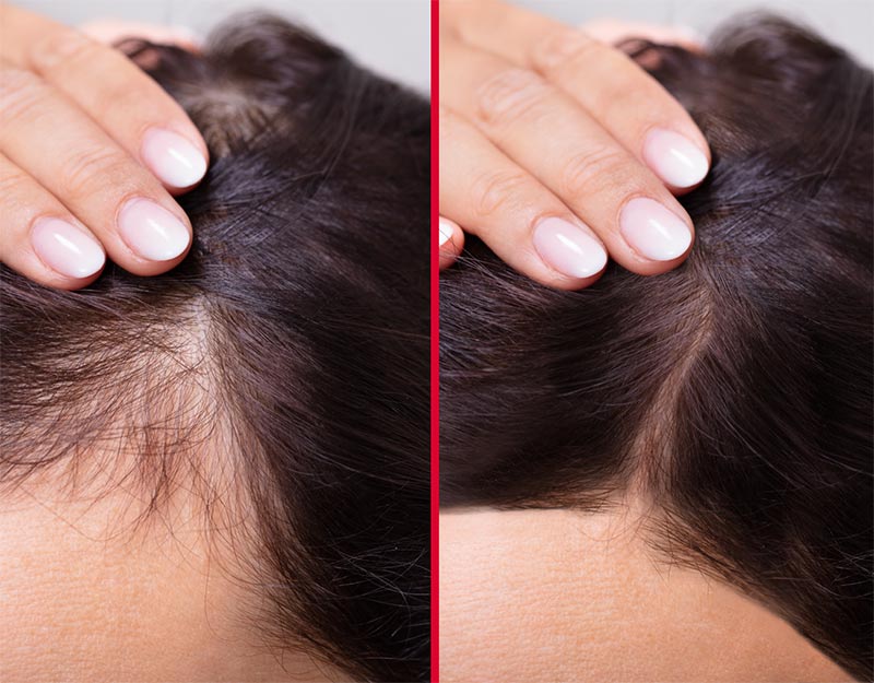 hair serum