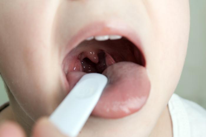 Conquering Throat Cancer in Jaipur