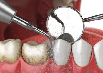 Periodontal Specialists Near Me: Expert Care for Your Gums + Exploring Bridges for Teeth Near Flint, MI