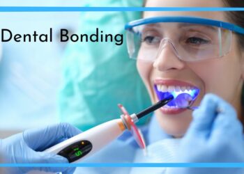Enhancing Your Smile with Dental Bonding in Anchorage, AK: Benefits, Process, and Alternatives