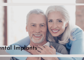 Long Lasting Dental Implants in Anchorage AK: The Ultimate Solution for a Confident Smile