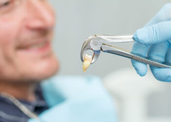 Dental Implant Supported Denture Teeth Flint MI: The Ultimate Solution for a Perfect Smile